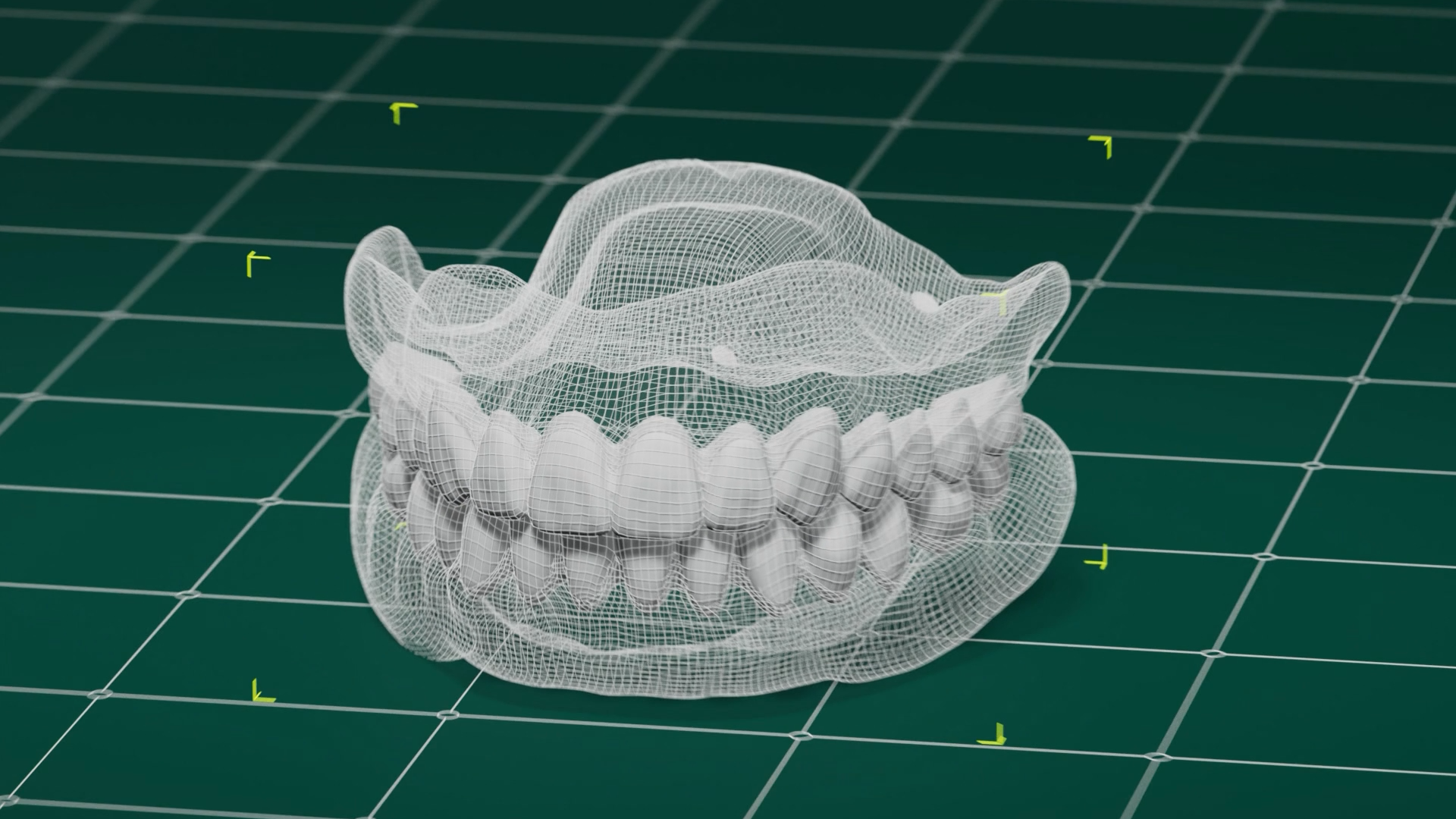 Fusion Dentures